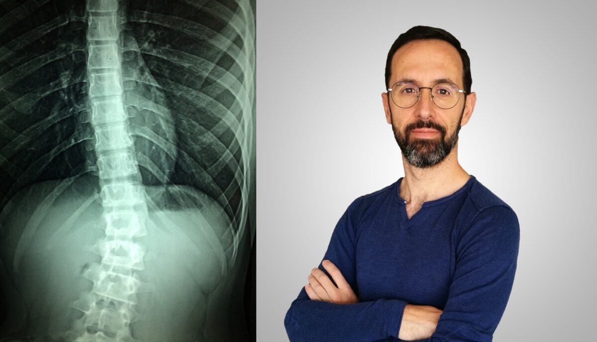 Implantes medulares con Daniel Pérez Marcos